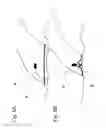 Fig. 07 - SURGICAL APPARATUS, METHOD FOR USING THE SURGICAL APPARATUS AND SUTURE METHOD