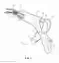 Fig. 02 - Intraoral stapler