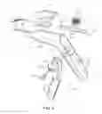 Fig. 04 - Intraoral stapler
