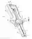 Fig. 02 - Surgical fastener applying apparatus