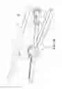 Fig. 04 - Surgical fastener applying apparatus