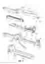 Fig. 06 - Surgical fastener applying apparatus