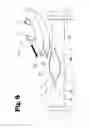 Fig. 09 - Vascular anastomosis device and method