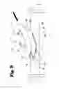 Fig. 10 - Vascular anastomosis device and method