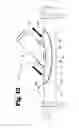 Fig. 14 - Vascular anastomosis device and method