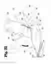 Fig. 22 - Vascular anastomosis device and method