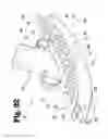 Fig. 23 - Vascular anastomosis device and method