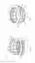 Fig. 02 - APPARATUS AND METHOD FOR STAGED COMPRESSION ANASTOMOSIS