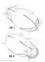 Fig. 03 - INSERTION SHROUD FOR SURGICAL INSTRUMENT