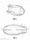 Fig. 04 - INSERTION SHROUD FOR SURGICAL INSTRUMENT