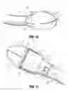 Fig. 07 - INSERTION SHROUD FOR SURGICAL INSTRUMENT