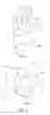 Fig. 05 - Method to stop bleeding, with short hemostasis duration using a low dose of anticoagulant