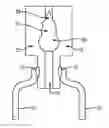 Fig. 01 - Composite detachment mechanisms