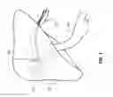 Fig. 02 - METHODS AND SYSTEMS FOR THERMOEMBOLIZATION