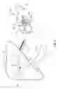 Fig. 03 - METHODS AND SYSTEMS FOR THERMOEMBOLIZATION