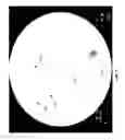 Fig. 08 - METHODS AND SYSTEMS FOR THERMOEMBOLIZATION