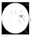 Fig. 09 - METHODS AND SYSTEMS FOR THERMOEMBOLIZATION