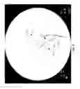 Fig. 10 - METHODS AND SYSTEMS FOR THERMOEMBOLIZATION