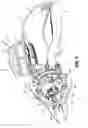 Fig. 04 - Surgical device with articulation and wrist rotation