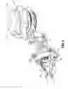 Fig. 05 - Surgical device with articulation and wrist rotation
