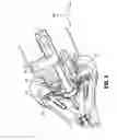 Fig. 07 - Surgical device with articulation and wrist rotation