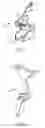Fig. 05 - Surgical device with knife lockout