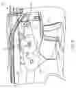 Fig. 07 - Surgical device with knife lockout
