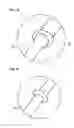 Fig. 04 - SURGICAL INSTRUMENT UTILIZING ULTRASONIC WAVES