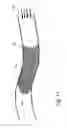 Fig. 09 - Atherectomy device