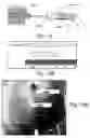 Fig. 17 - DERMAL MICRO-ORGANS, METHODS AND APPARATUSES FOR PRODUCING AND USING THE SAME