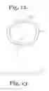 Fig. 08 - Polyaxial bone anchor with polymer sleeve