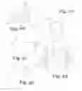 Fig. 12 - Polyaxial bone anchor with polymer sleeve