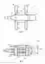 Fig. 05 - Spinous process fusion devices