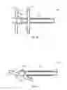Fig. 06 - Spinous process fusion devices