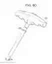 Fig. 16 - Systems and methods for spinal fixation