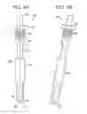 Fig. 17 - Systems and methods for spinal fixation