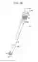 Fig. 19 - Systems and methods for spinal fixation