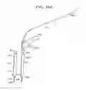 Fig. 23 - Systems and methods for spinal fixation