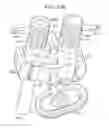 Fig. 37 - Systems and methods for spinal fixation