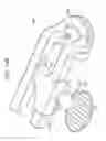 Fig. 40 - Systems and methods for spinal fixation