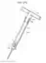 Fig. 76 - Systems and methods for spinal fixation