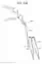 Fig. 78 - Systems and methods for spinal fixation