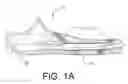 Fig. 02 - Nail System and Method for an Olecranon Osteotomy