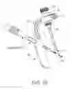 Fig. 20 - Nail System and Method for an Olecranon Osteotomy