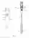 Fig. 15 - Expandable intramedullary systems and methods of using the same