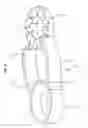 Fig. 06 - FIXING DEVICE FOR BONE FRACTURES