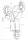 Fig. 11 - FIXING DEVICE FOR BONE FRACTURES