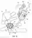 Fig. 14 - Bone plate system and method