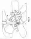 Fig. 19 - Bone plate system and method