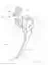 Fig. 58 - Bone plate system and method
